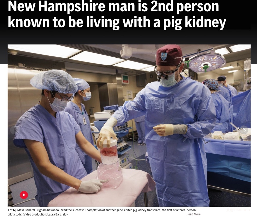 醫(yī)學突破！全球第二例基因編輯豬腎移植患者康復出院 異種移植邁入新階段-肽度TIMEDOO