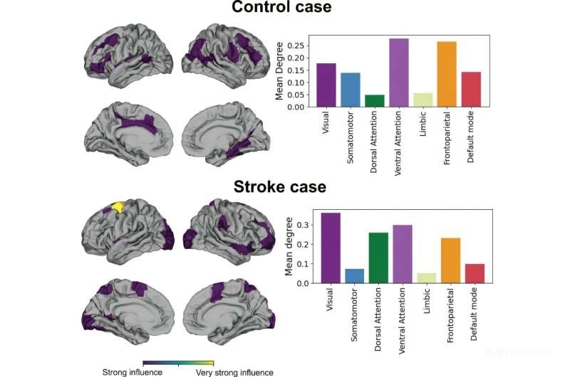 能“看懂”的AI+腦網(wǎng)絡分析 國際團隊研發(fā)中風精準診斷新技術-肽度TIMEDOO