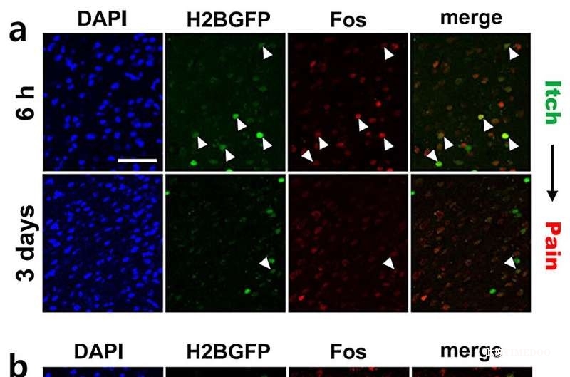 大腦如何區(qū)分疼痛和瘙癢-肽度TIMEDOO