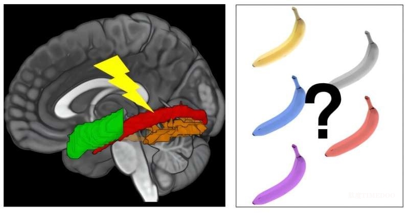 研究發(fā)現(xiàn):人腦儲(chǔ)存熟悉物體信息依賴視覺與語言系統(tǒng)的連接-肽度TIMEDOO