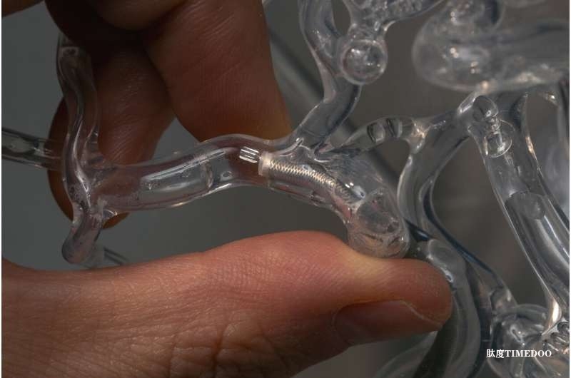 斯坦福研發(fā)“微旋取栓器”，有望大幅提升中風(fēng)與血栓治療成功率-肽度TIMEDOO