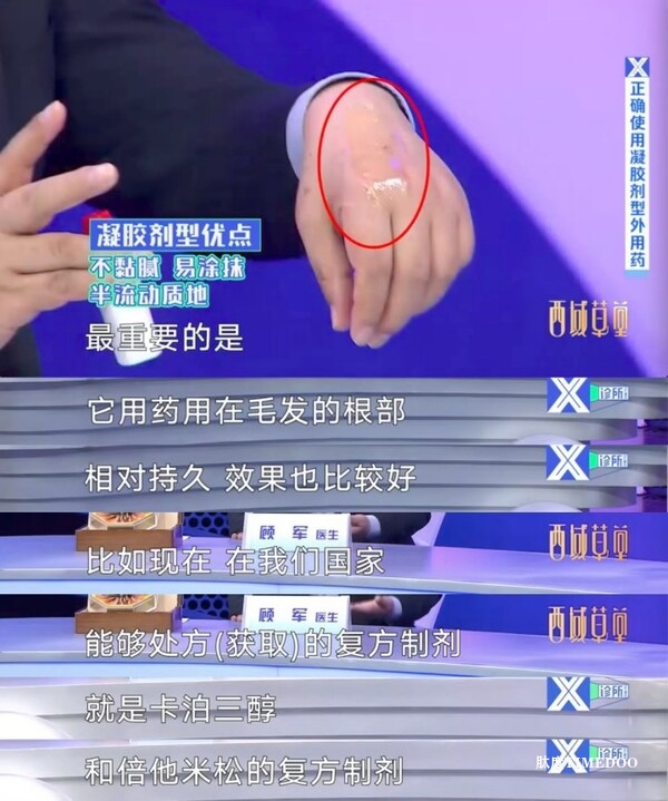 2025世界銀屑病日呼吁：正認知、早干預(yù)、穩(wěn)控制，擁抱健康生活-肽度TIMEDOO